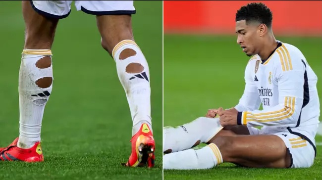 EXPLAINED: Why footballers cut holes in their socks before matches